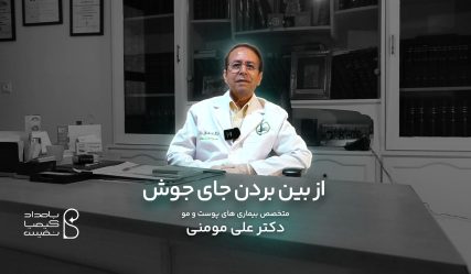 دکتر مومنی جای جوش