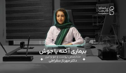 آکنه یا جوش سقراطی